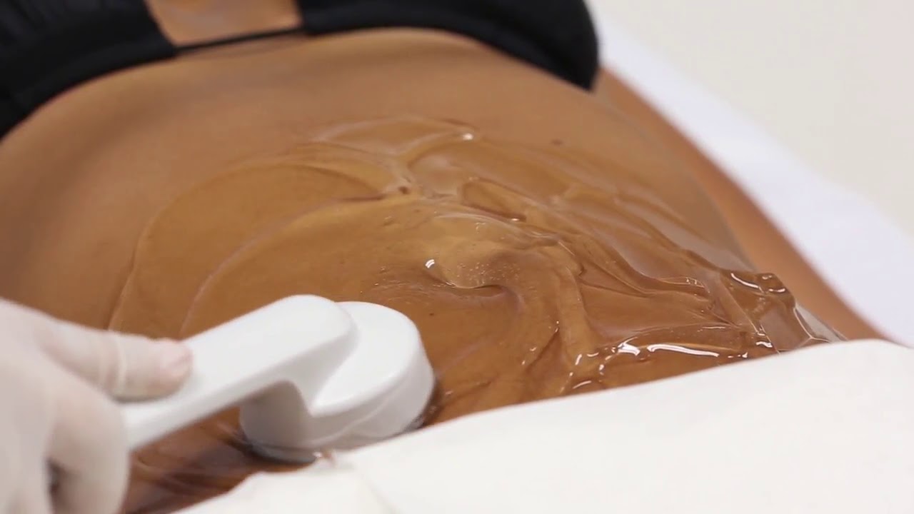 Ultrassom » Fisioterapia e Estética Ultrassom » Fisioterapia e Estética