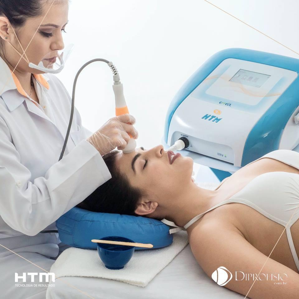 Radiofrequência no tratamento de acne Radiofrequência no tratamento de acne
